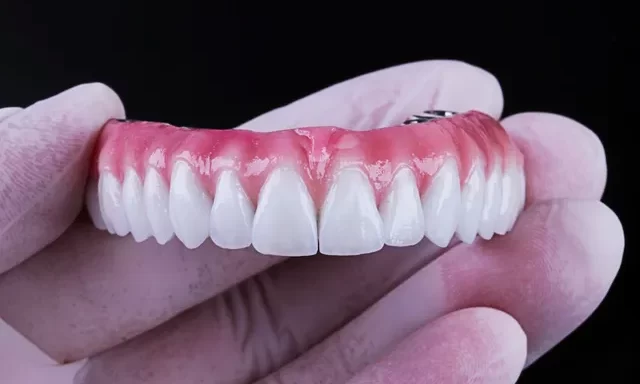 Próteses Dentárias