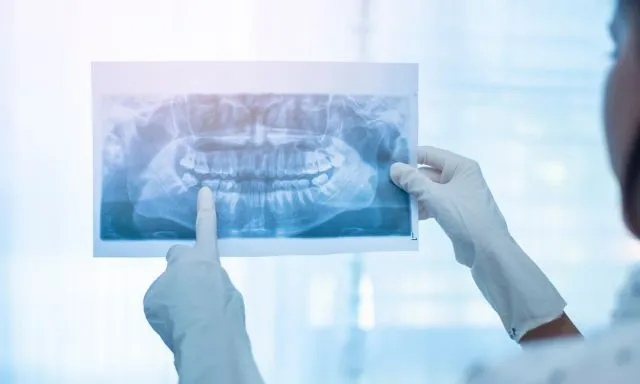 Radiografia Odontológica